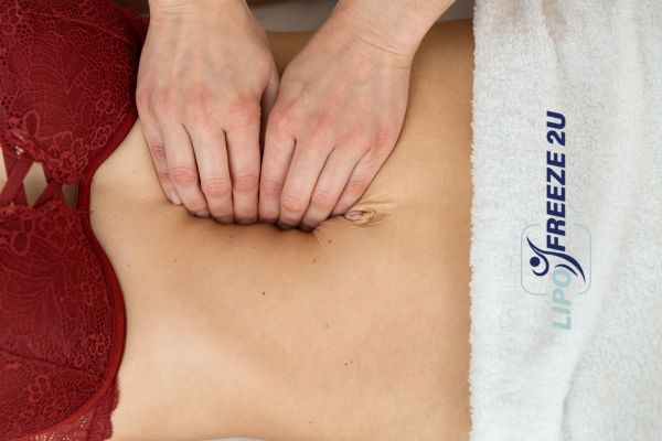 diastasis recti treatment Waltham Abbey