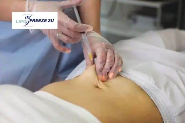 How Does Aqualyx Fat Dissolving Injection Work to Break Down Fat Waltham Abbey?