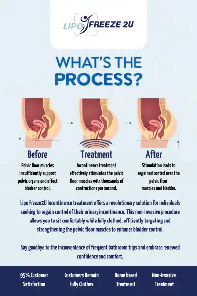 Diagram of how incontinence treatment Waltham Abbey works.