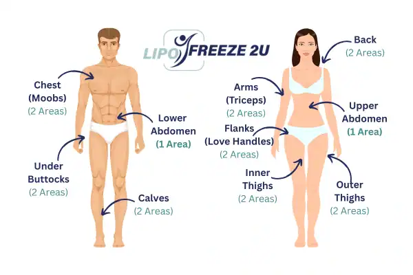 Areas you can have fat freezing treatment Waltham Abbey