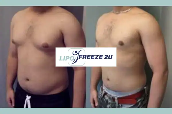 How Long Does It Take to See Results Waltham Abbey?