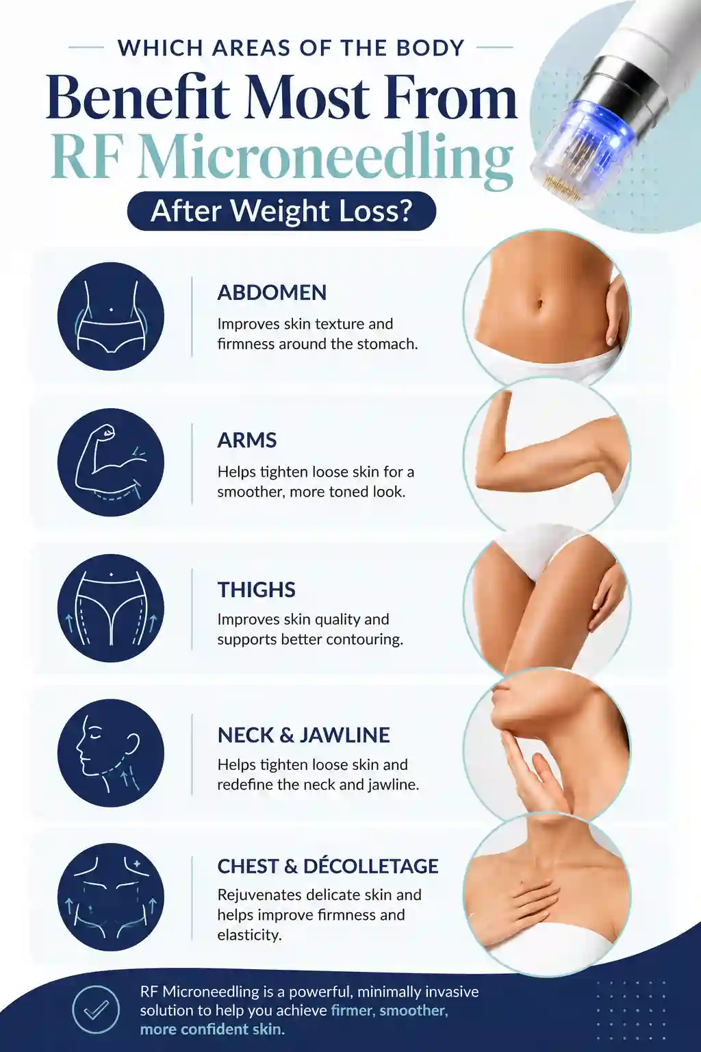 Which Areas of the Body Benefit Most From RF Microneedling After Weight Loss Waltham Abbey